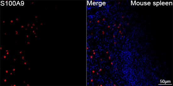 S100A9 Antibody in Immunohistochemistry (Paraffin) (IHC (P))