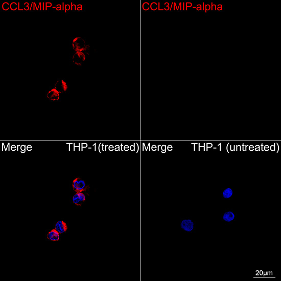 CCL3 Antibody in Immunocytochemistry (ICC/IF)