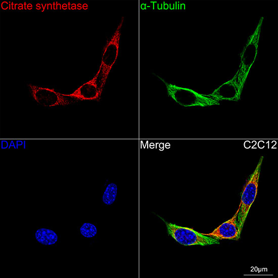 Citrate Synthase Antibody in Immunocytochemistry (ICC/IF)