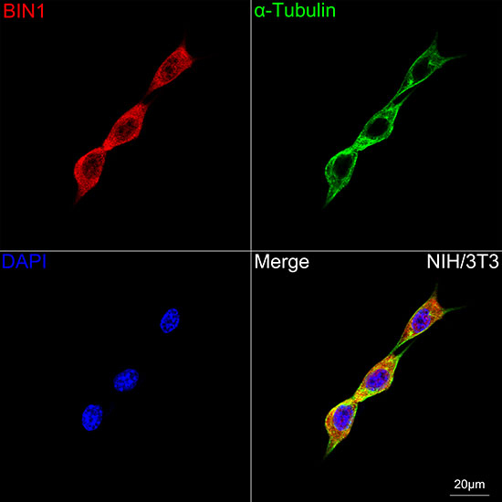 BIN1 Antibody in Immunocytochemistry (ICC/IF)