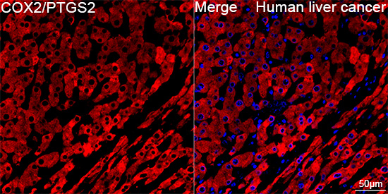 COX2 Antibody in Immunohistochemistry (Paraffin) (IHC (P))