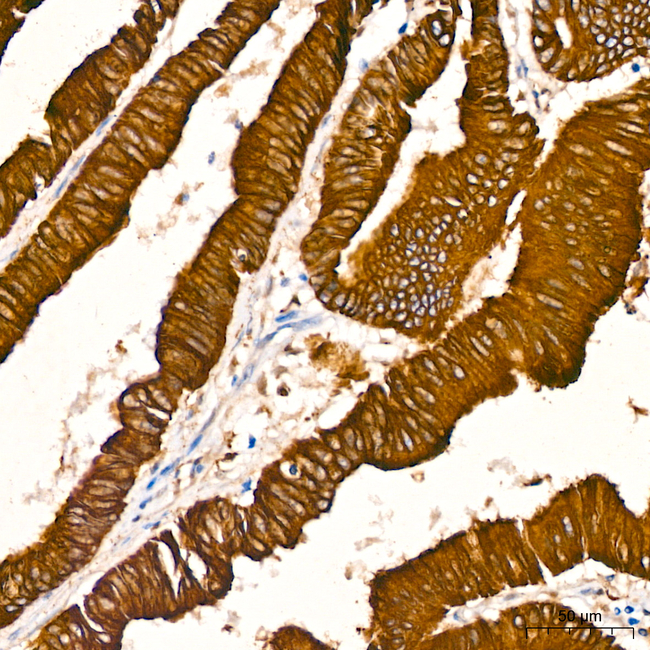 Cytokeratin 19 Antibody in Immunohistochemistry (Paraffin) (IHC (P))