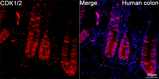 CDK1/CDK2 Antibody in Immunohistochemistry (Paraffin) (IHC (P))