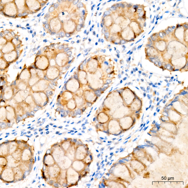 IL-12 p40 Antibody in Immunohistochemistry (Paraffin) (IHC (P))