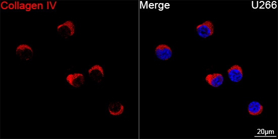 Collagen IV Antibody in Immunocytochemistry (ICC/IF)