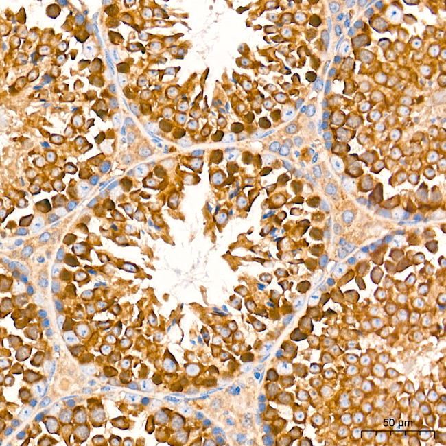 RIP3 Antibody in Immunohistochemistry (Paraffin) (IHC (P))