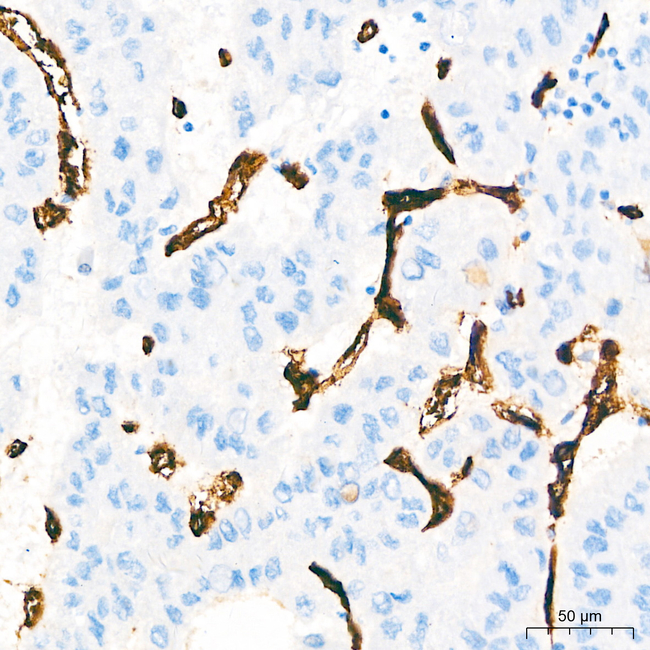 CD34 Antibody in Immunohistochemistry (Paraffin) (IHC (P))