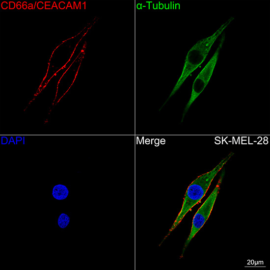 CD66a Antibody in Immunocytochemistry (ICC/IF)