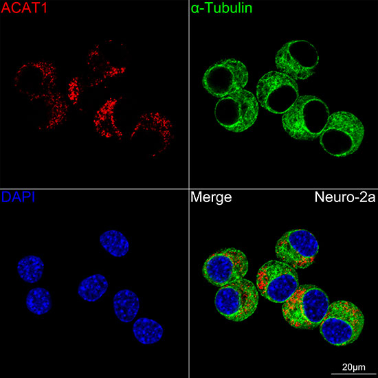 ACAT1 Antibody in Immunocytochemistry (ICC/IF)