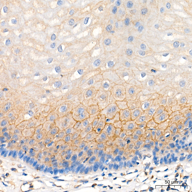MLKL Antibody in Immunohistochemistry (Paraffin) (IHC (P))