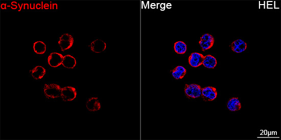 alpha Synuclein Antibody in Immunocytochemistry (ICC/IF)