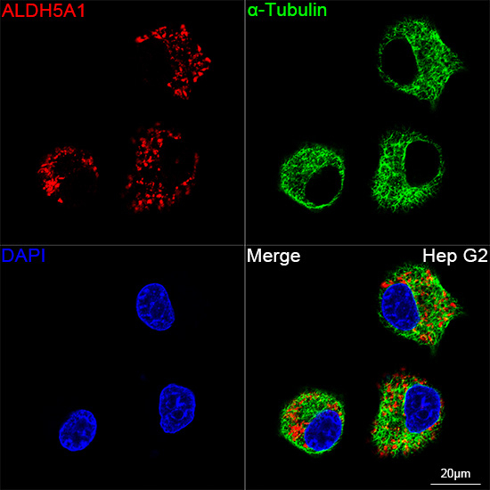 ALDH5A1 Antibody in Immunocytochemistry (ICC/IF)