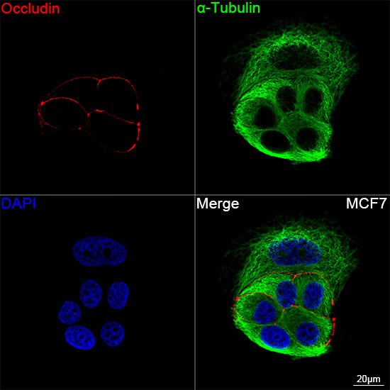 Occludin Antibody in Immunocytochemistry (ICC/IF)