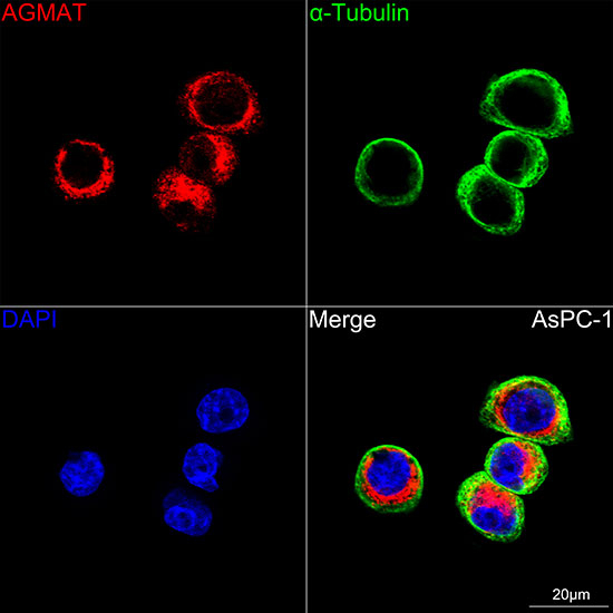 AGMAT Antibody in Immunocytochemistry (ICC/IF)