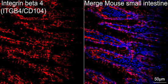 CD104 Antibody in Immunohistochemistry (Paraffin) (IHC (P))