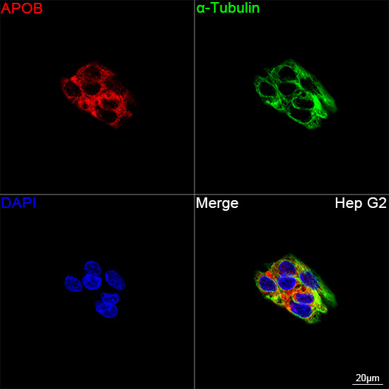 Apolipoprotein B Antibody in Immunocytochemistry (ICC/IF)