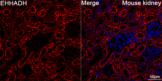 EHHADH Antibody in Immunohistochemistry (Paraffin) (IHC (P))