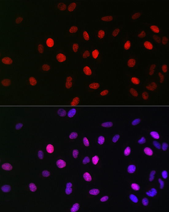 H3K23ac Antibody in Immunocytochemistry (ICC/IF)