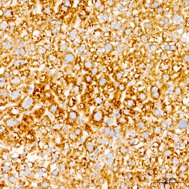 ABHD6 Antibody in Immunohistochemistry (Paraffin) (IHC (P))