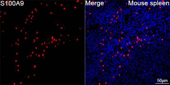S100A9 Antibody in Immunohistochemistry (Paraffin) (IHC (P))