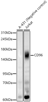 CD96 Antibody in Western Blot (WB)