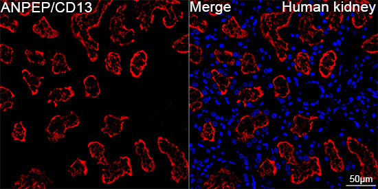 CD13 Antibody in Immunohistochemistry (Paraffin) (IHC (P))