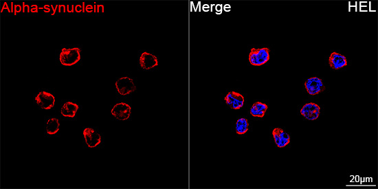alpha Synuclein Antibody in Immunocytochemistry (ICC/IF)
