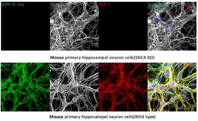 alpha Synuclein Antibody in Immunocytochemistry (ICC/IF)