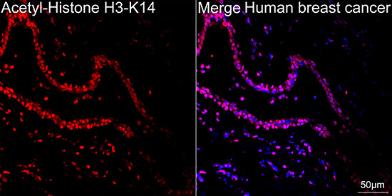 H3K14ac Antibody in Immunohistochemistry (Paraffin) (IHC (P))
