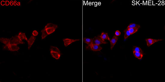 CD66a Antibody in Immunocytochemistry (ICC/IF)