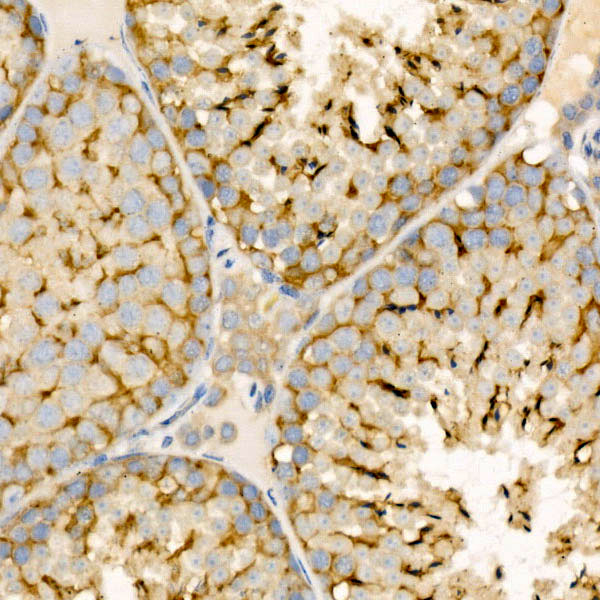 STIM1 Antibody in Immunohistochemistry (Paraffin) (IHC (P))