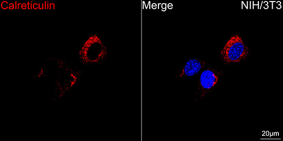 Calreticulin Antibody in Immunocytochemistry (ICC/IF)