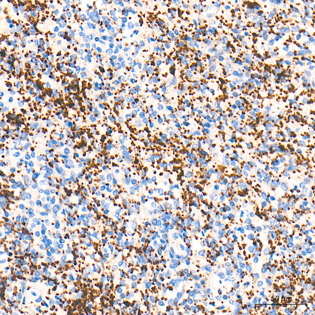Thrombospondin-1 Antibody in Immunohistochemistry (Paraffin) (IHC (P))