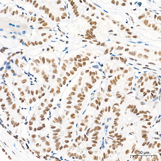 FAM208A Antibody in Immunohistochemistry (Paraffin) (IHC (P))