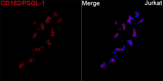 CD162 Antibody in Immunocytochemistry (ICC/IF)