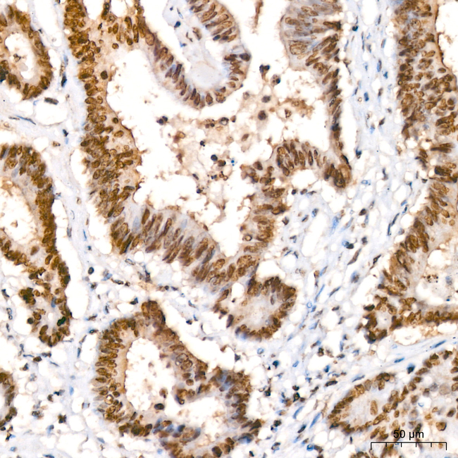 Lactyl-Histone H4 (Lys5) Antibody in Immunohistochemistry (Paraffin) (IHC (P))