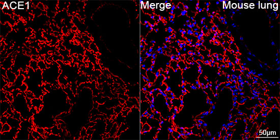 ACE Antibody in Immunohistochemistry (Paraffin) (IHC (P))