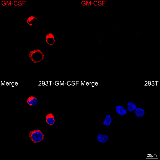 CSF2 Antibody in Immunocytochemistry (ICC/IF)