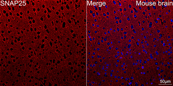 SNAP25 Antibody in Immunohistochemistry (Paraffin) (IHC (P))