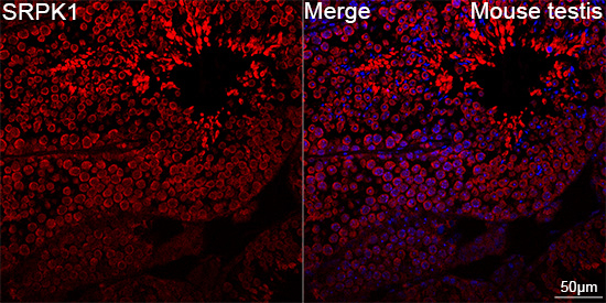SRPK1 Antibody in Immunohistochemistry (Paraffin) (IHC (P))