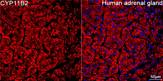 CYP11B2 Antibody in Immunohistochemistry (Paraffin) (IHC (P))