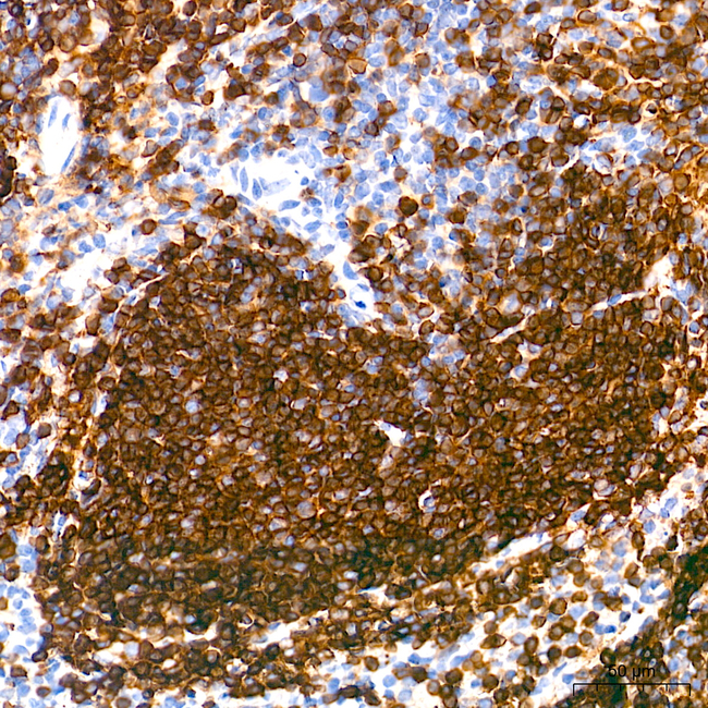 CD22 Antibody in Immunohistochemistry (Paraffin) (IHC (P))