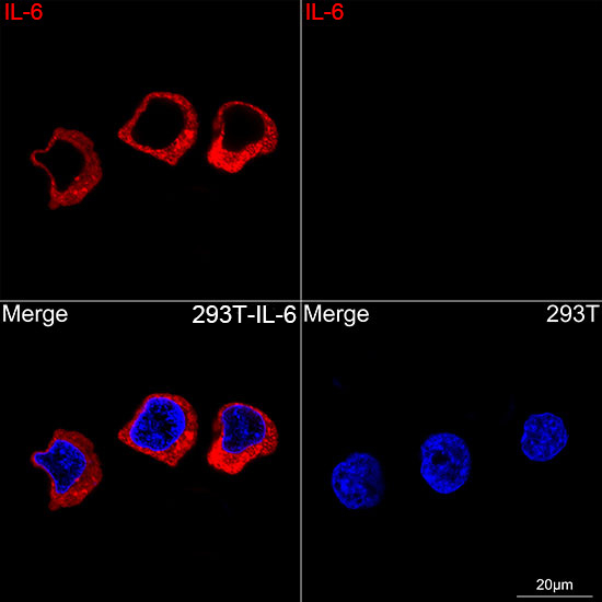 IL-6 Antibody in Immunocytochemistry (ICC/IF)