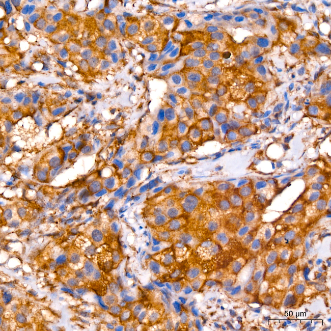 MVP Antibody in Immunohistochemistry (Paraffin) (IHC (P))