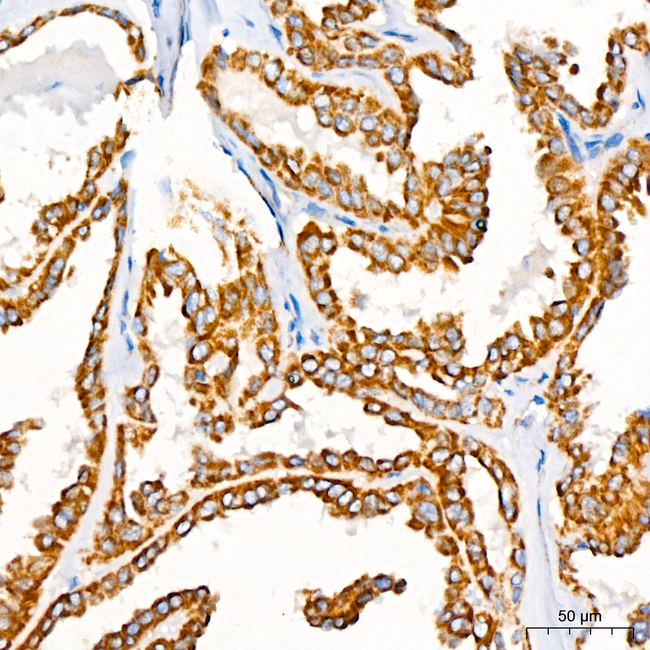 GPD2 Antibody in Immunohistochemistry (Paraffin) (IHC (P))