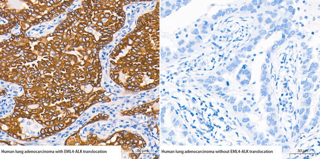 ALK Antibody in Immunohistochemistry (Paraffin) (IHC (P))