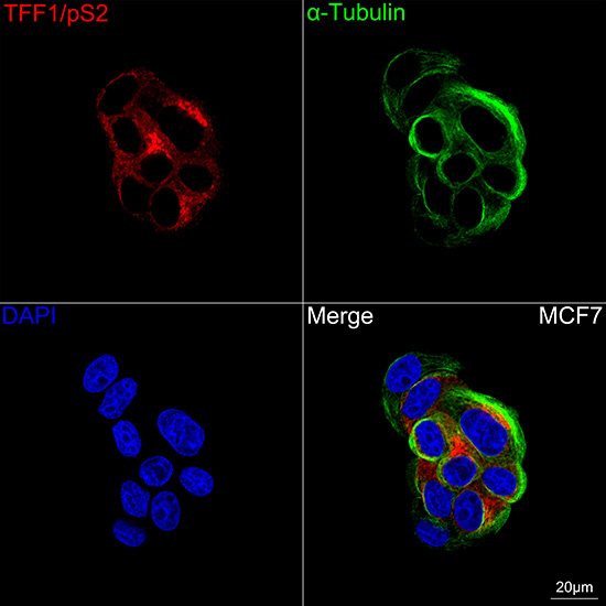 TFF1 Antibody in Immunocytochemistry (ICC/IF)