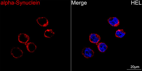 alpha Synuclein Antibody in Immunocytochemistry (ICC/IF)