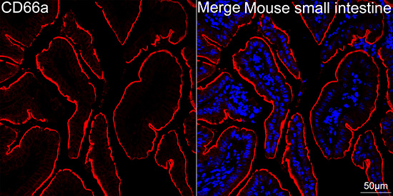 CD66a Antibody in Immunohistochemistry (Paraffin) (IHC (P))
