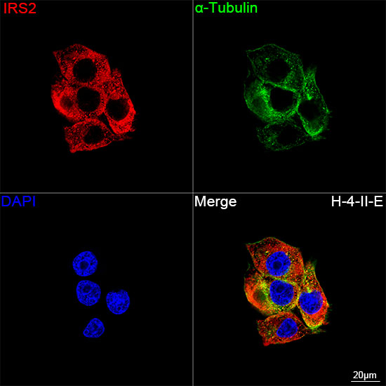 IRS2 Antibody in Immunocytochemistry (ICC/IF)